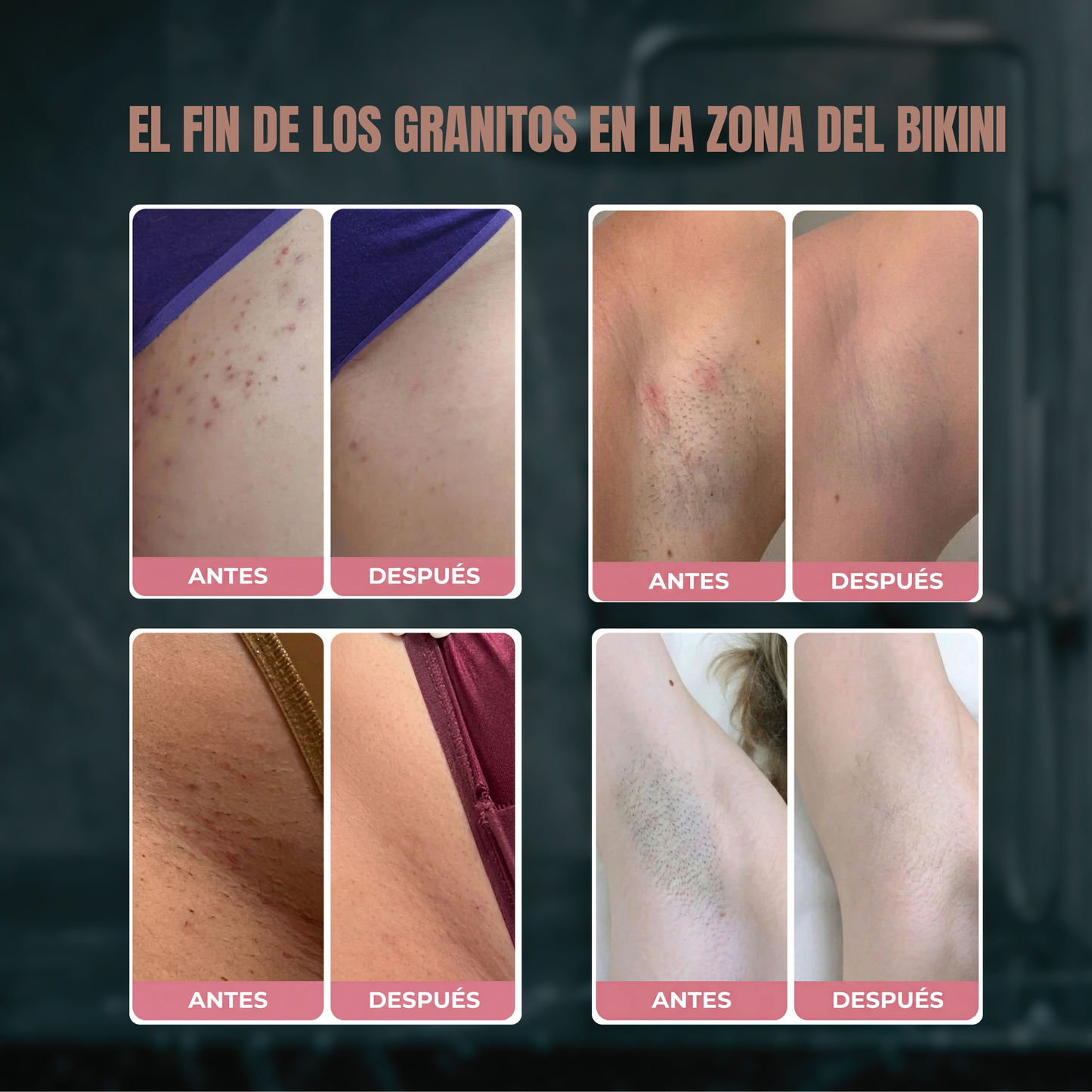 Rasuradora Zeni Dermacare (2 en 1)